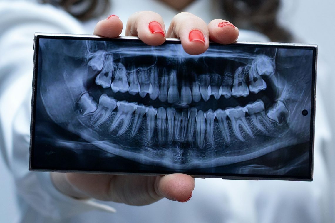 california-dental-implant-specialists-photo (11)